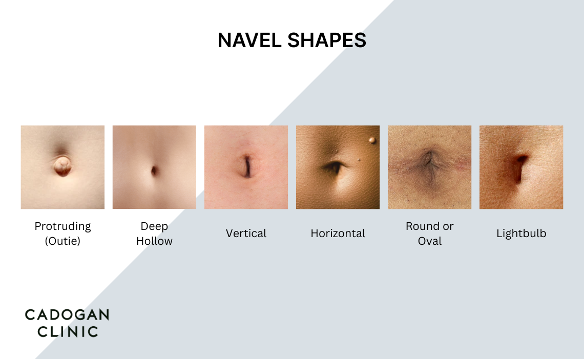 Infographic showing different navel shapes